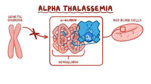 alfha thallasemia